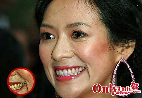 怎么Photoshop相片使牙齿变白？