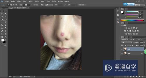 <esred>PS</esred><esred>图片</esred><esred>如何</esred><esred>去</esred>痘？