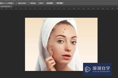<esred>PS</esred><esred>去</esred><esred>痘痘</esred>的方法