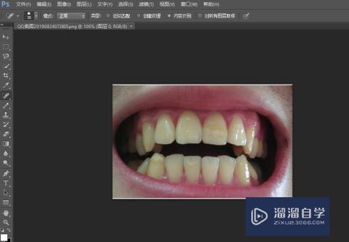 如何使用<esred>Photo</esred><esred>shop</esred>来美<esred>白</esred>牙齿？