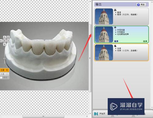 CAD义齿设计绘制教程(cad义齿设计教程视频)