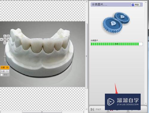 CAD义齿设计绘制教程(cad义齿设计教程视频)