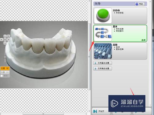 CAD义齿设计绘制教程(cad义齿设计教程视频)