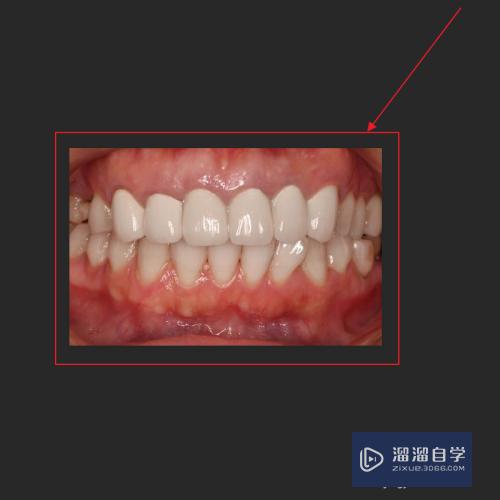 PS如何设置将牙齿变白？